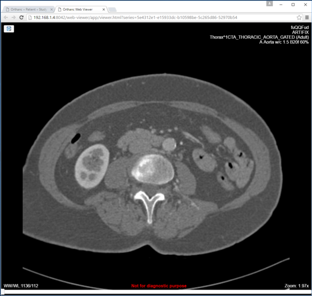 Orthanc Web Viewer example image